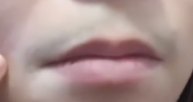 可能導(dǎo)致女性長胡子的原因