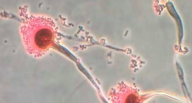 致命真菌曲霉素在美蔓延